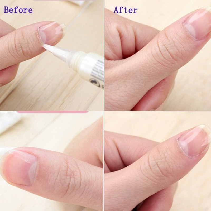 1 pz Penna Olio Cuticole, Olio - Cuticle Oil Pen recensione e prezzo